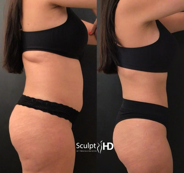 Antes e depois 3