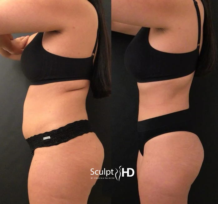Antes e depois 4