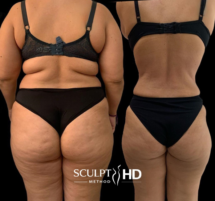 Antes e depois 6